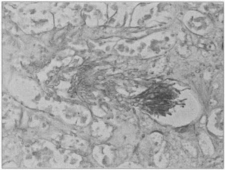 Fig. 9Kidney-histology