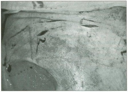 Fig. 8Taking four histological samples