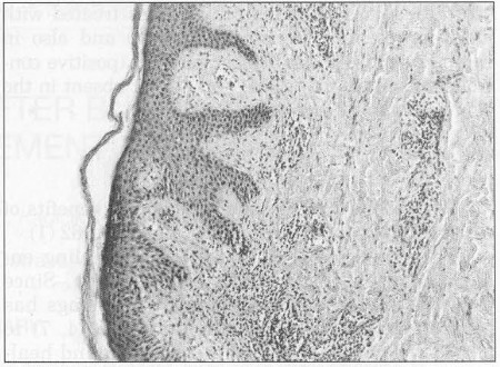 Fig. 13HE staining (magnification 16x). Healthy skin after application of interactive dressings during 48 hours. Histological view papillary et reticular de, mis, stratum basalc and clear vacuoles in cytoplasm 7sof inside stratum ,limosum. thin layer of'squamous epithelial cells