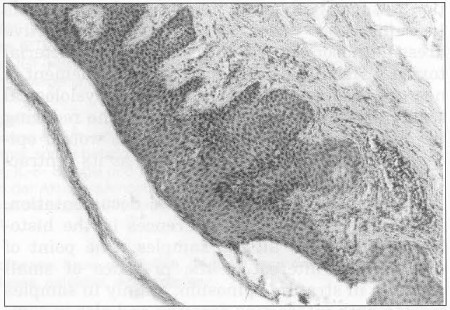 Fig. 15HE staining (magnification 16x) Intact skin (without treatment of interactive dressings). Histological view: reticular and papillary layer of dermis with blood vessels, base ment membrane, layer of epidermis-stratum basale, spinosum and curneum