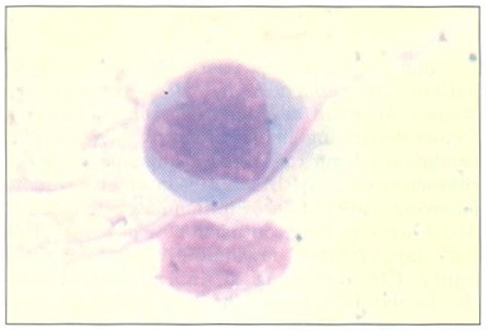 Fig. 3 a