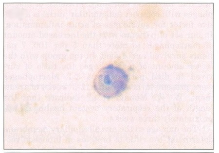 Fig. 4 a