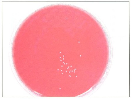 Fig. 1Consecutive sui face colonisation by Staphylococcus aureus