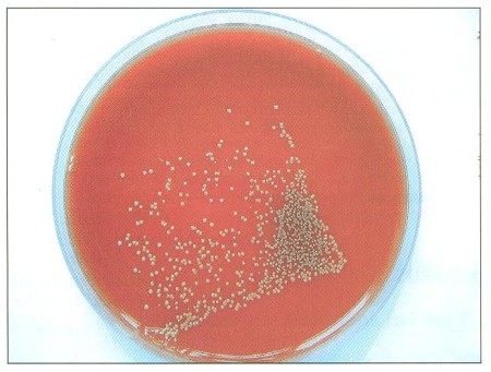 Fig. 2Consecutive sui face colonisation by Staphylococcus aureus