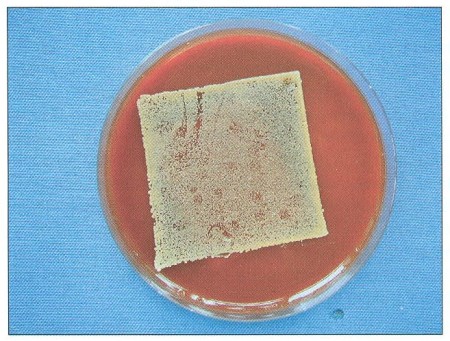 Fig. 3Consecutive sui face colonisation by Staphylococcus aureus