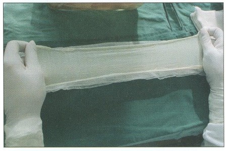 Fig. 1Porcine xenografts are prepared as thin dermo-epidermal sheets 30 x 7 cm