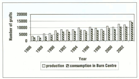Fig. 3The increase of xenograft production during the existence of Prague Skin Bank