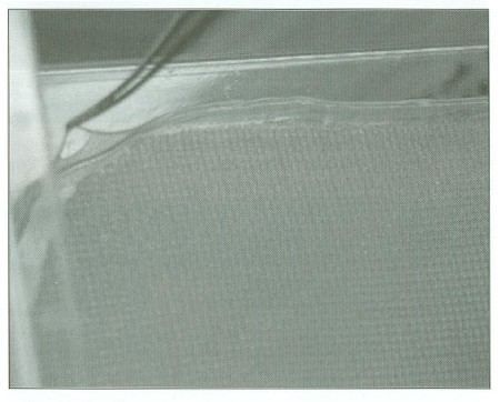 Fig. 6Confluent growth of cultured ker ul inocytes t, enzymatically detached from culture flask and mechanically at tached to a sheet of vazeline gauze