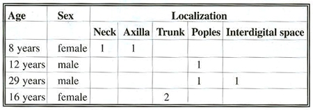 Table 1Using Integra 3/2003-8/2004, reconstruction after burn injury
