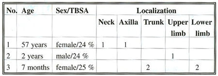 Table 2Using Integra 5/2003-8/2003, after excision