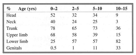 Table 9Scalding - localization