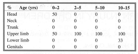 Table 11Electricity - localization