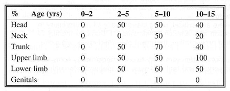 Table 12Burning - localization
