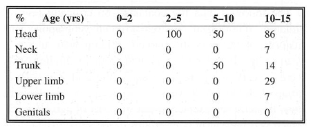 Table 13Explosion - localization