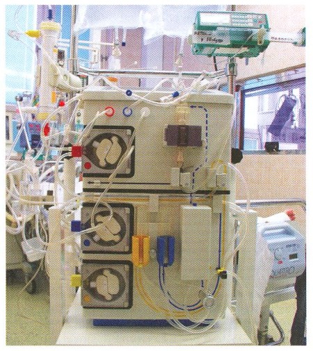 Fig. 1Fresenius ADM 08 after starting inserting