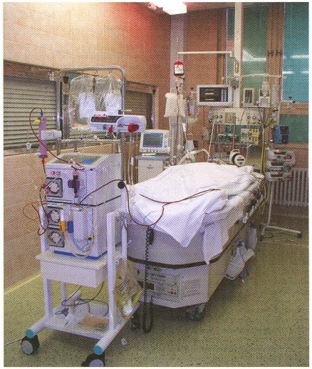 Fig. 1Fresenius ADM 08 after starting the procedure