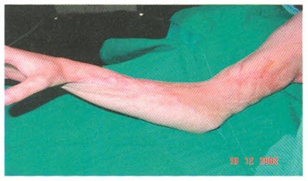a