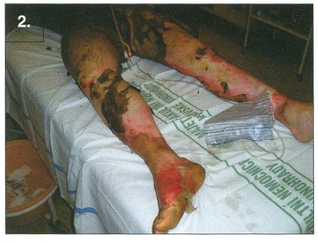 Fig. 2General view of the patient on admission