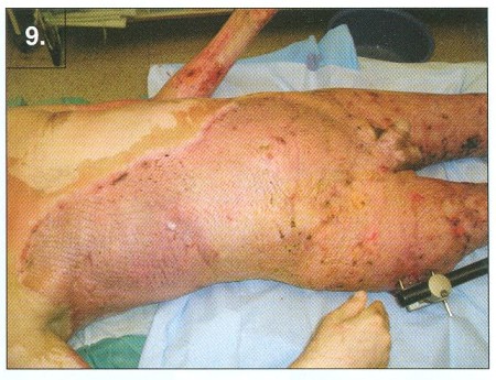 Fig. 9