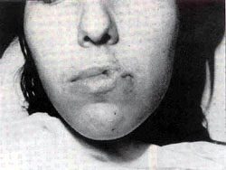 Fig. 8Resultado después del primer tiempo.<br><b>Fig.8</b> Result after the first Stage.