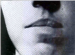 Fig. 11