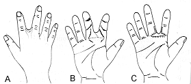 Fig. (2) 