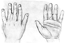 Fig. (3)