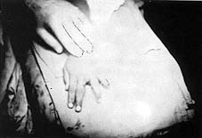 Fig. (4,D): At the end of operation.