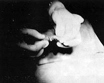 Fig. (4,E): At the end of operation.