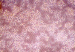 Fig. (1-A): Bacterial contamination of keratincoyte culture. Inverted phase micrograph magnified 100 X