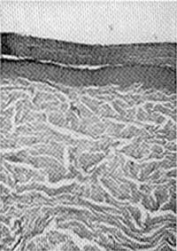 Fig. (6): Low power magnification