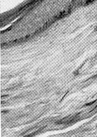 Fig. (9): High power magnification.