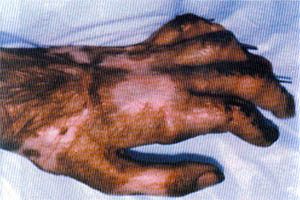 Fig. (2-B): Post-operative view of case-2