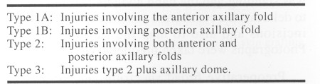 Table(1)Classification of axillary contractures (Kurtzamn and Stern, 1990). 