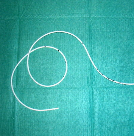 Photo N° 3sonde naso-gastrique